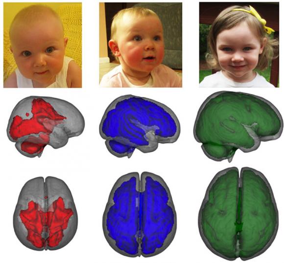 मस्तिष्क के विकास में महत्वपूर्ण भूमिका निभाता हैं माँ का दूध